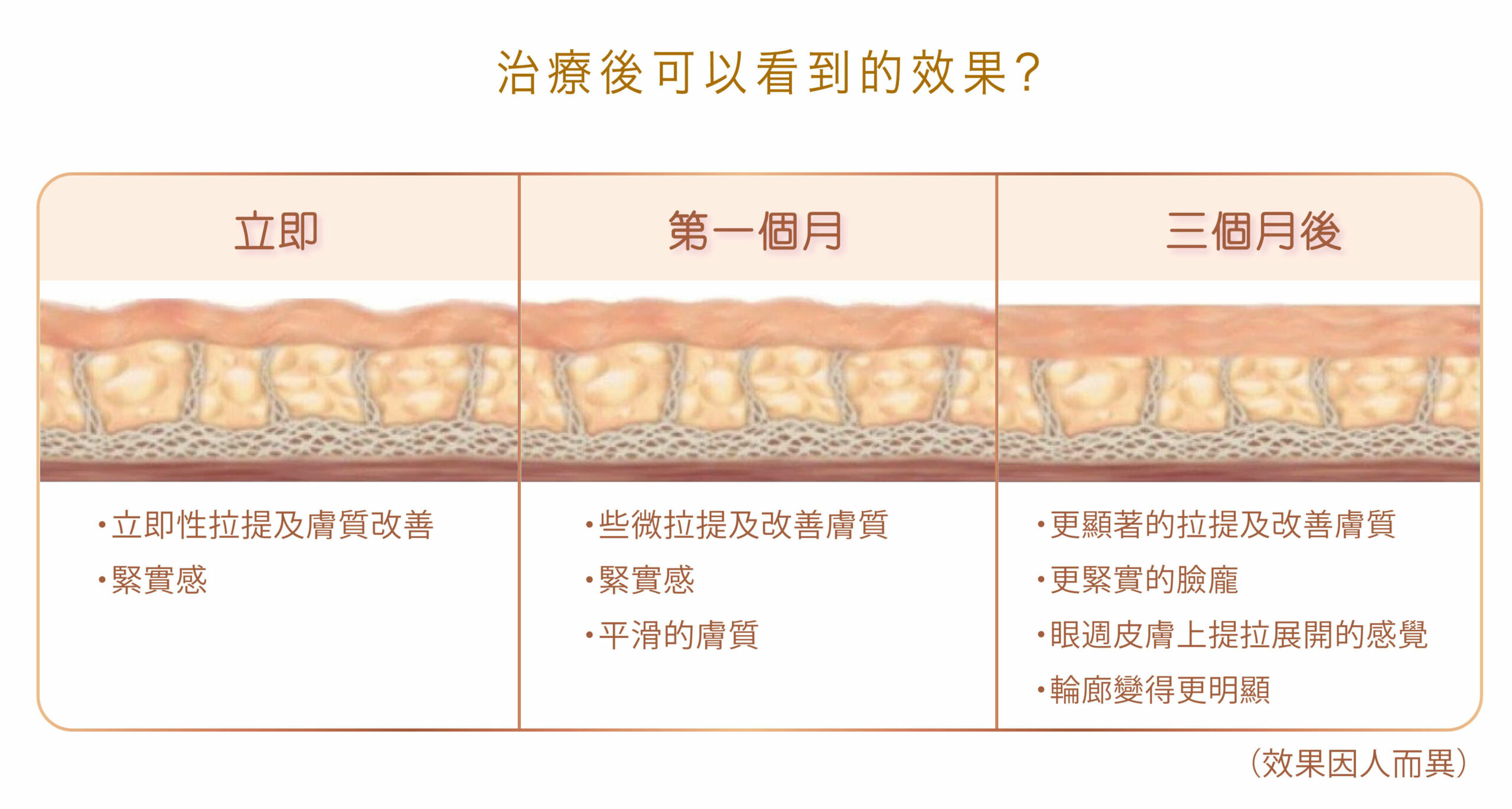 ulthera