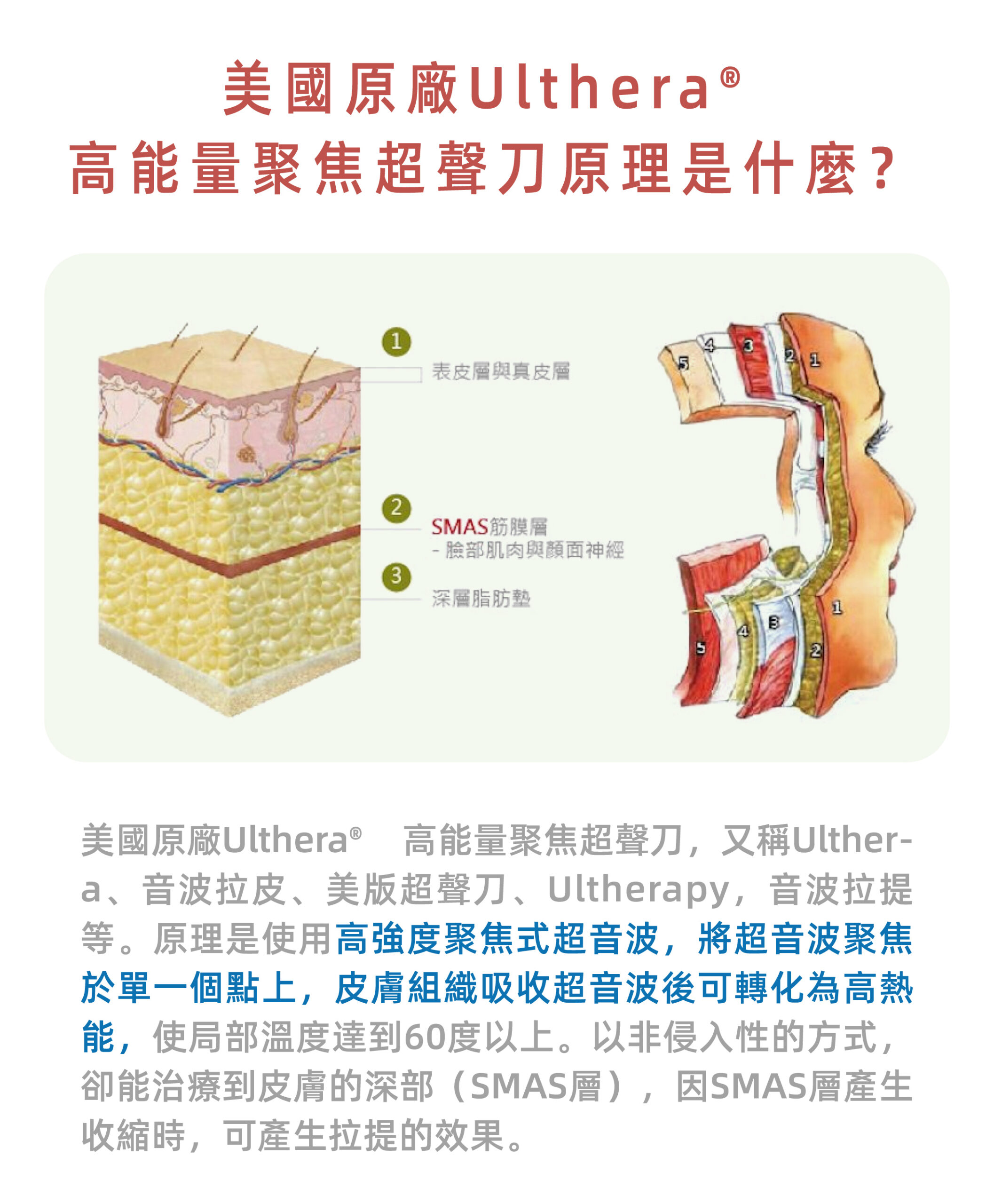 ulthera