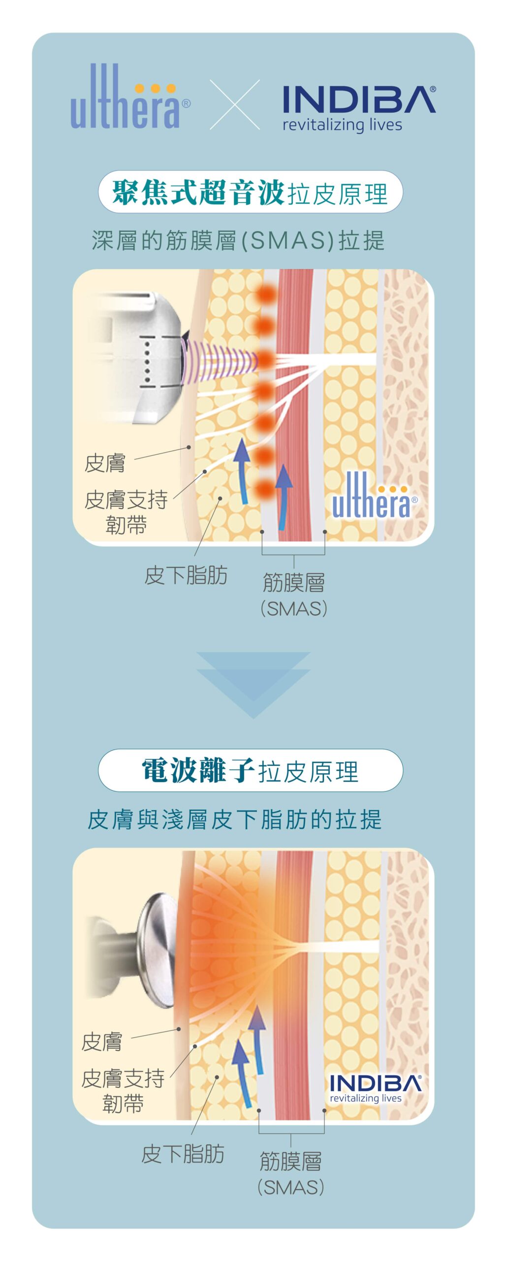 ulthera