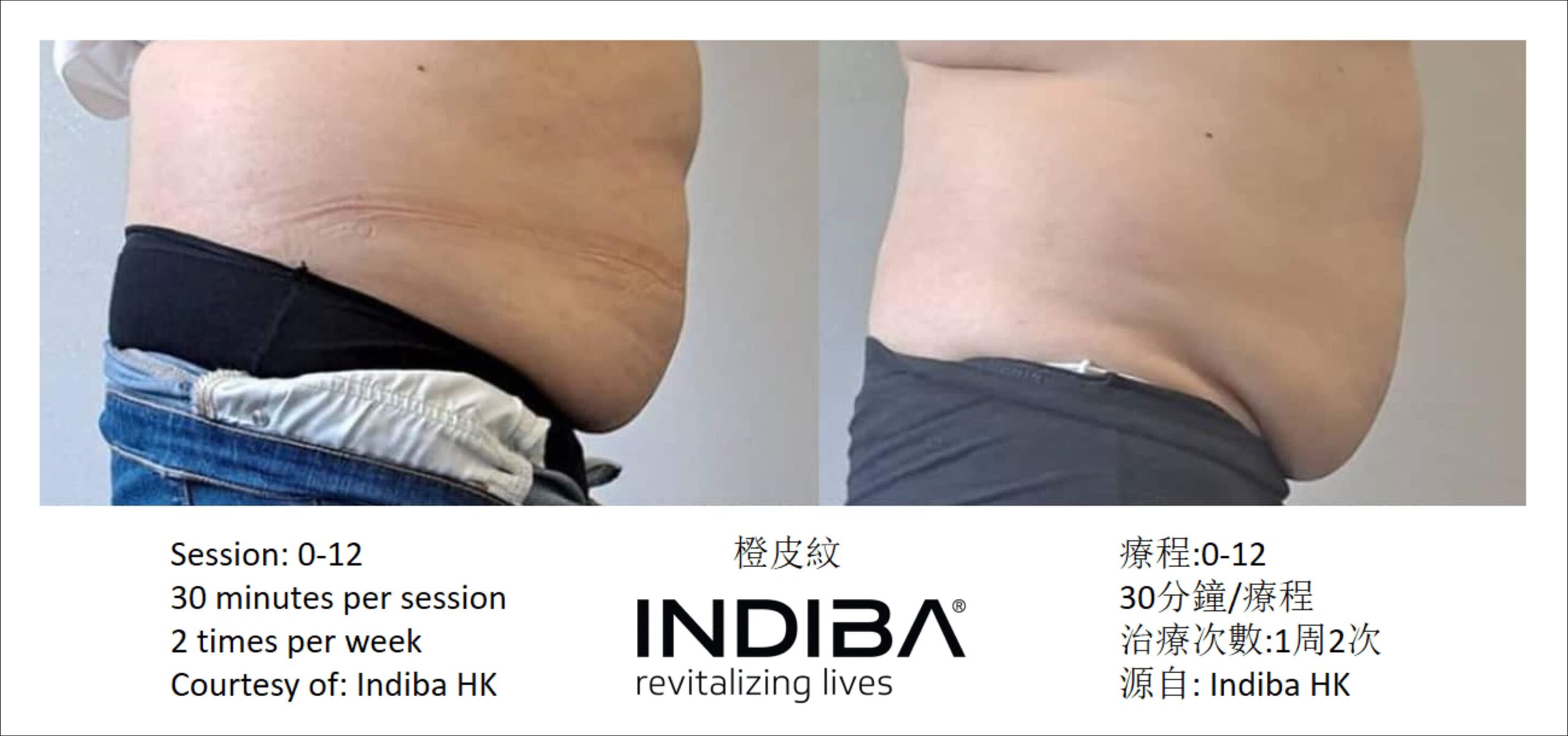 indiba_compare-01