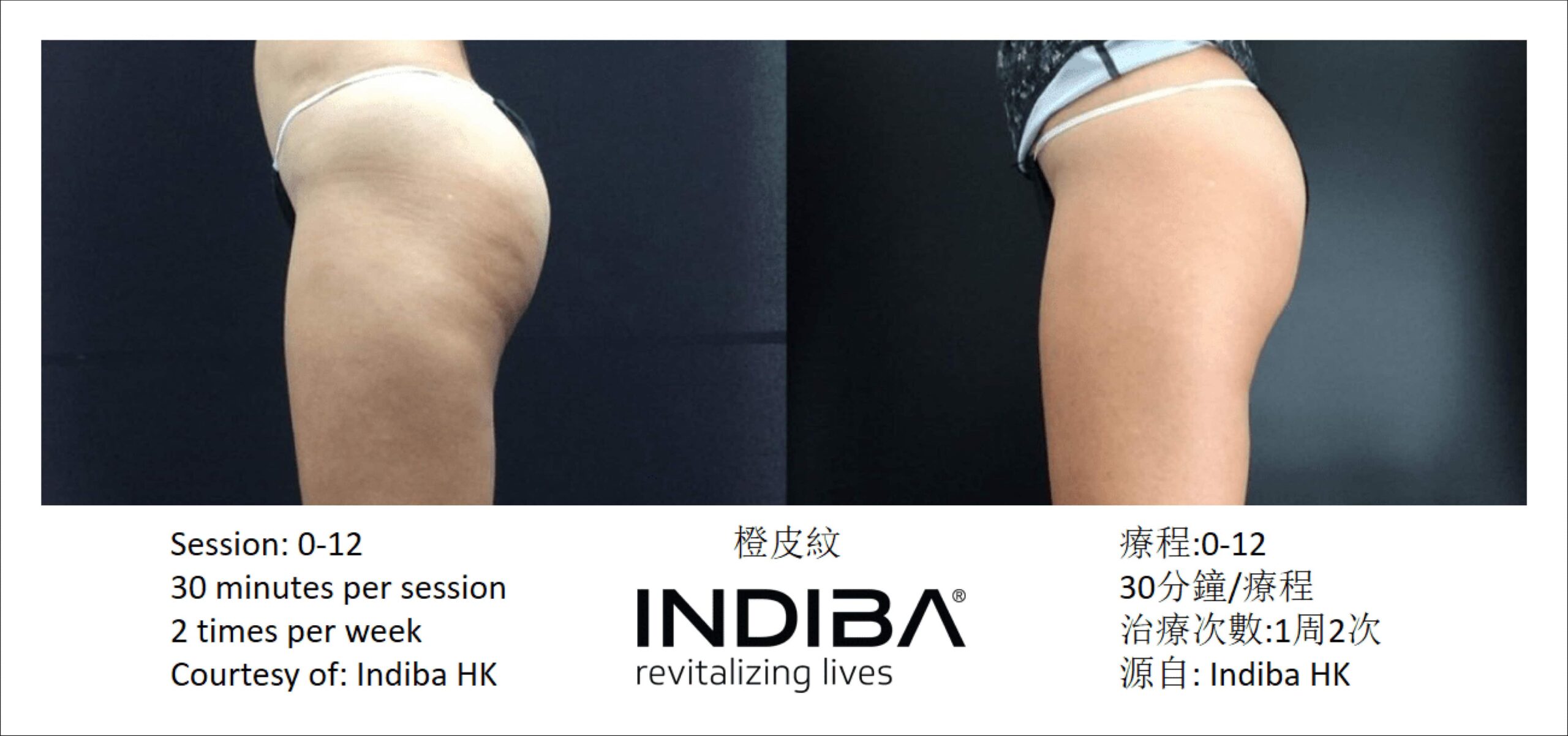 indiba_compare-06