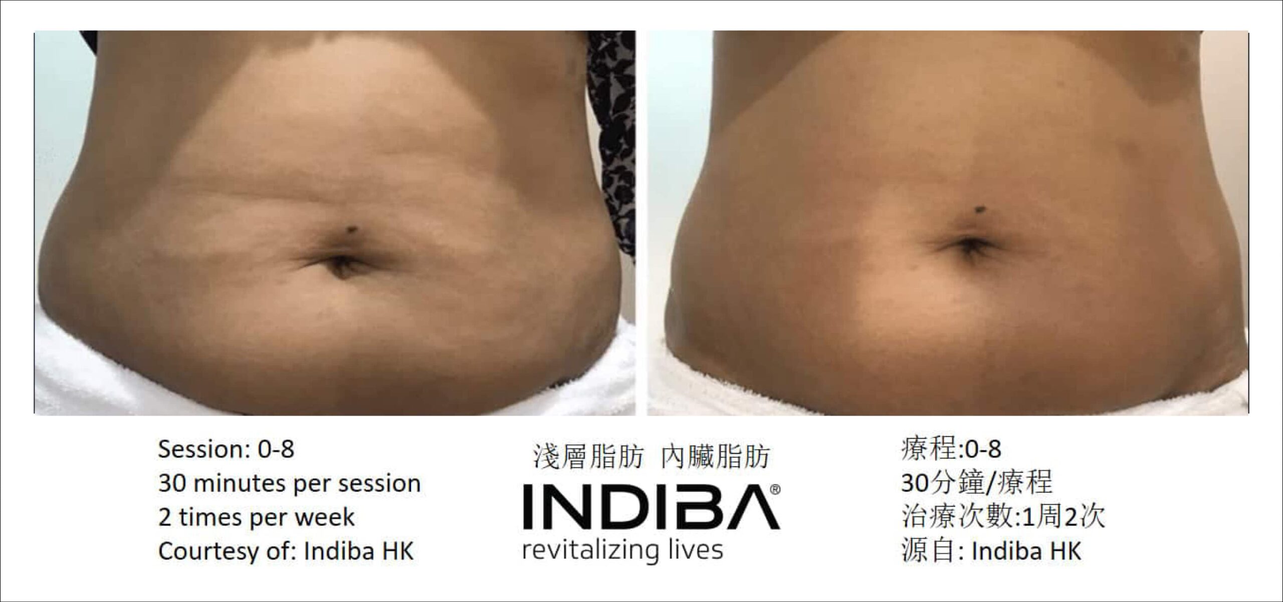 indiba_compare-07