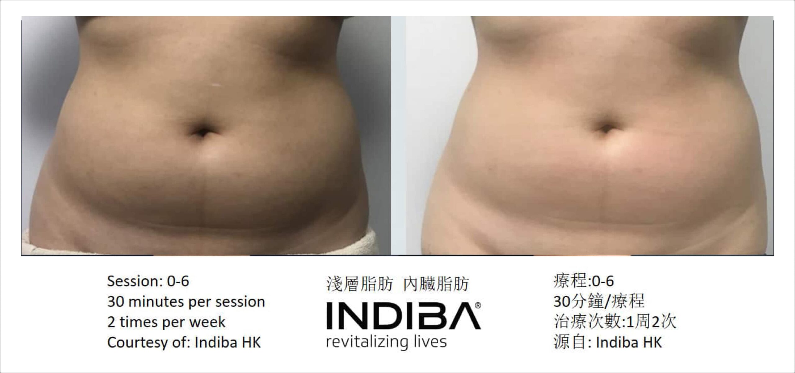 indiba_compare-10