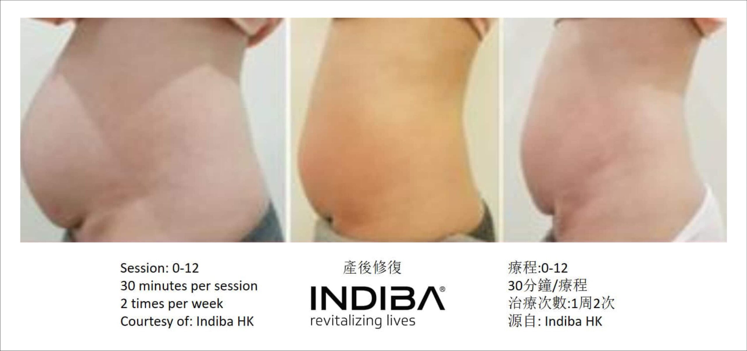 indiba_compare-15