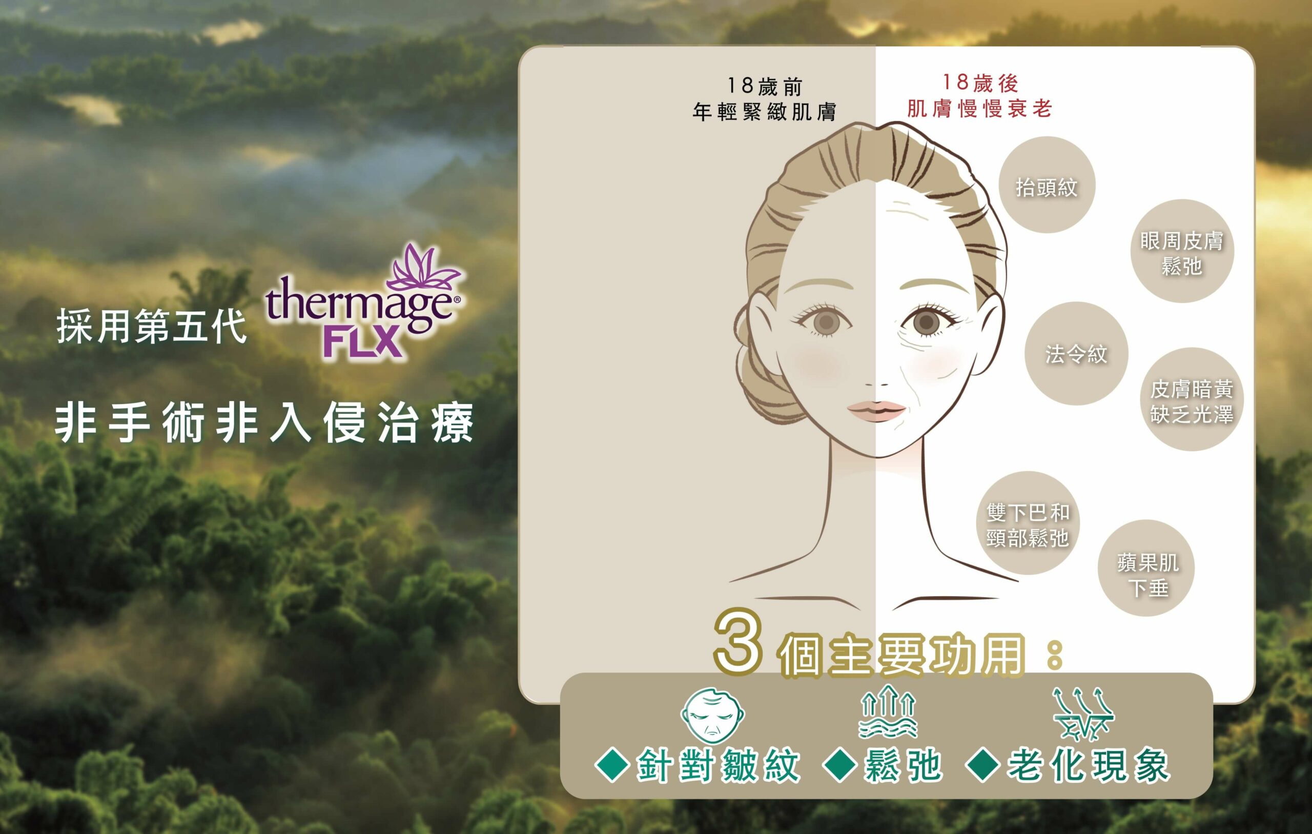 Thermage