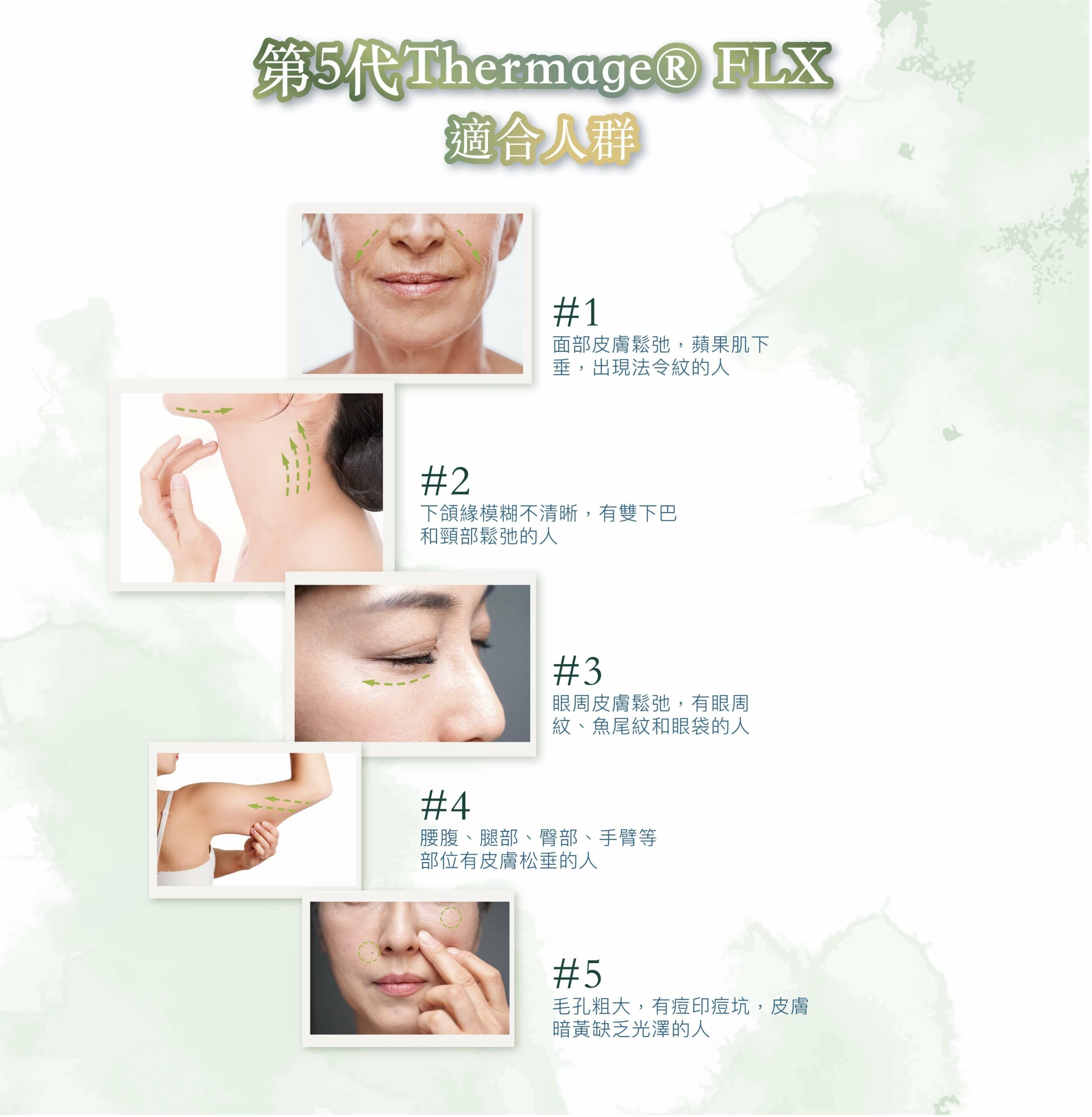 Thermage