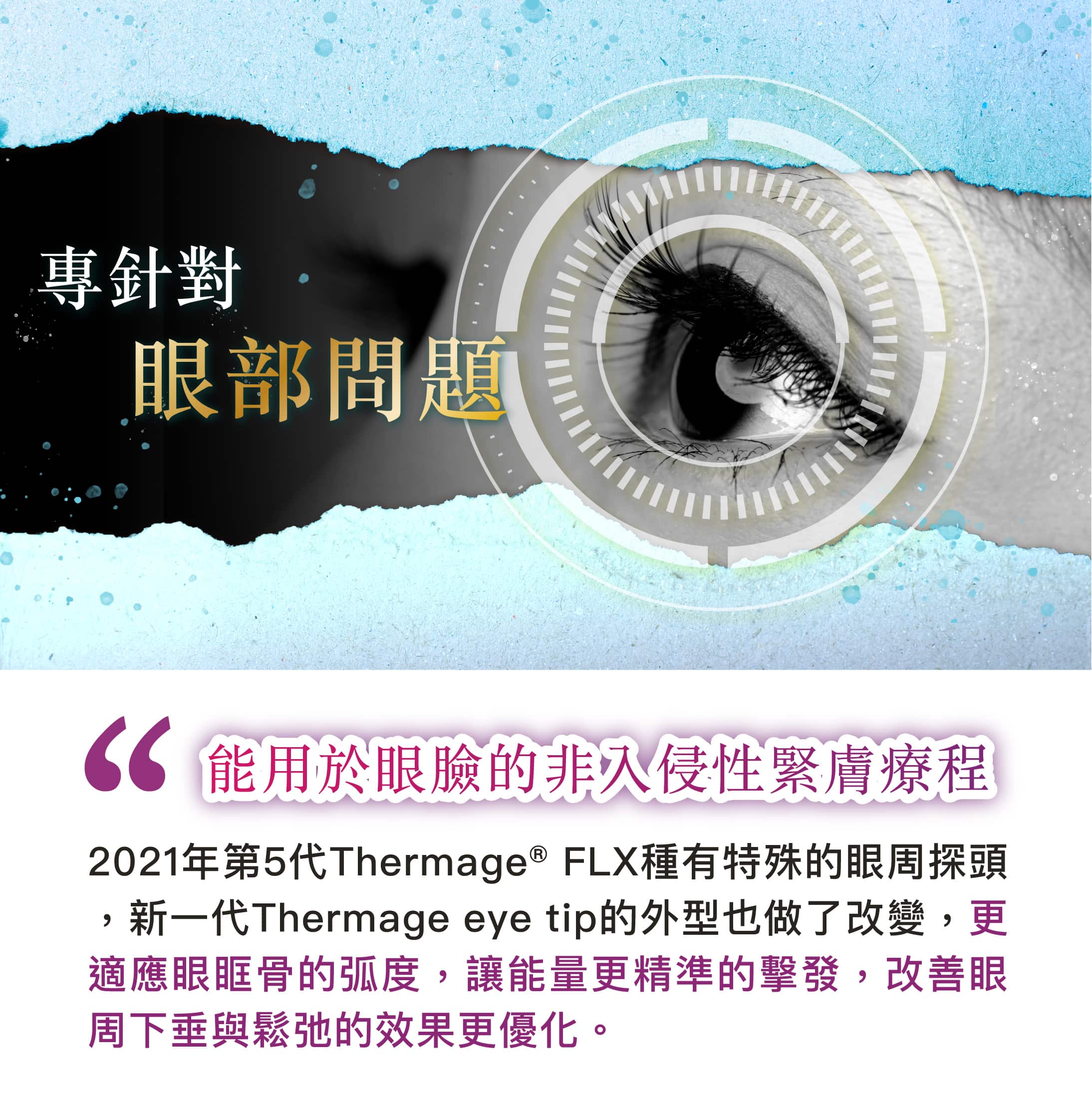 Thermage