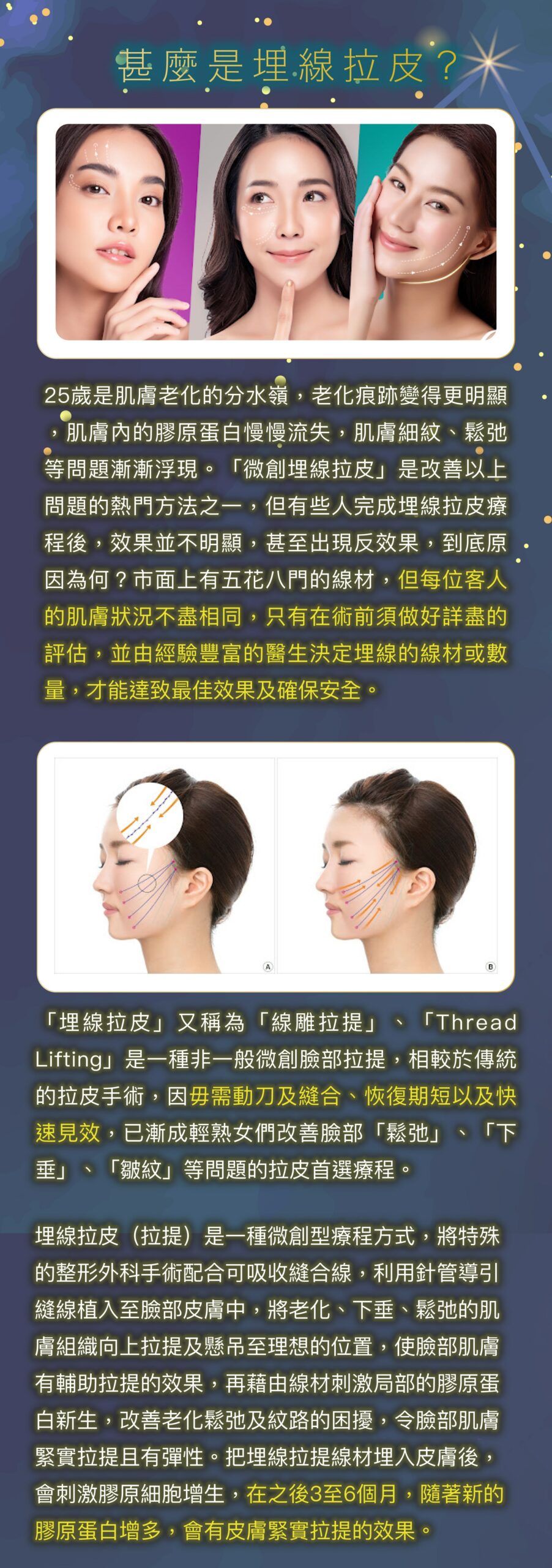 thread_lifting