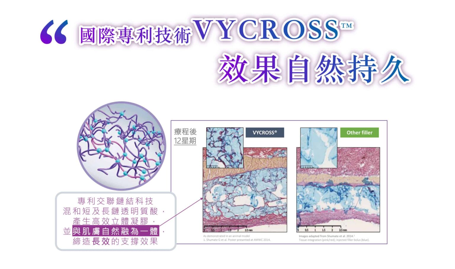 juvederm-3