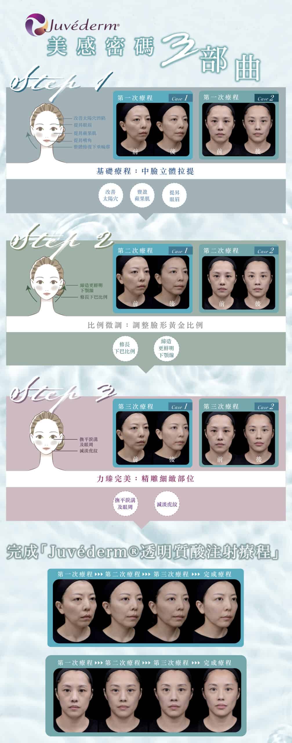 restylane_vs_juvederm