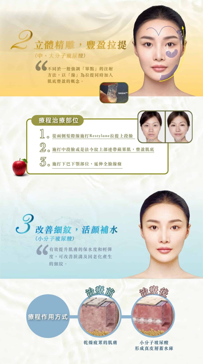 restylane_vs_juvederm