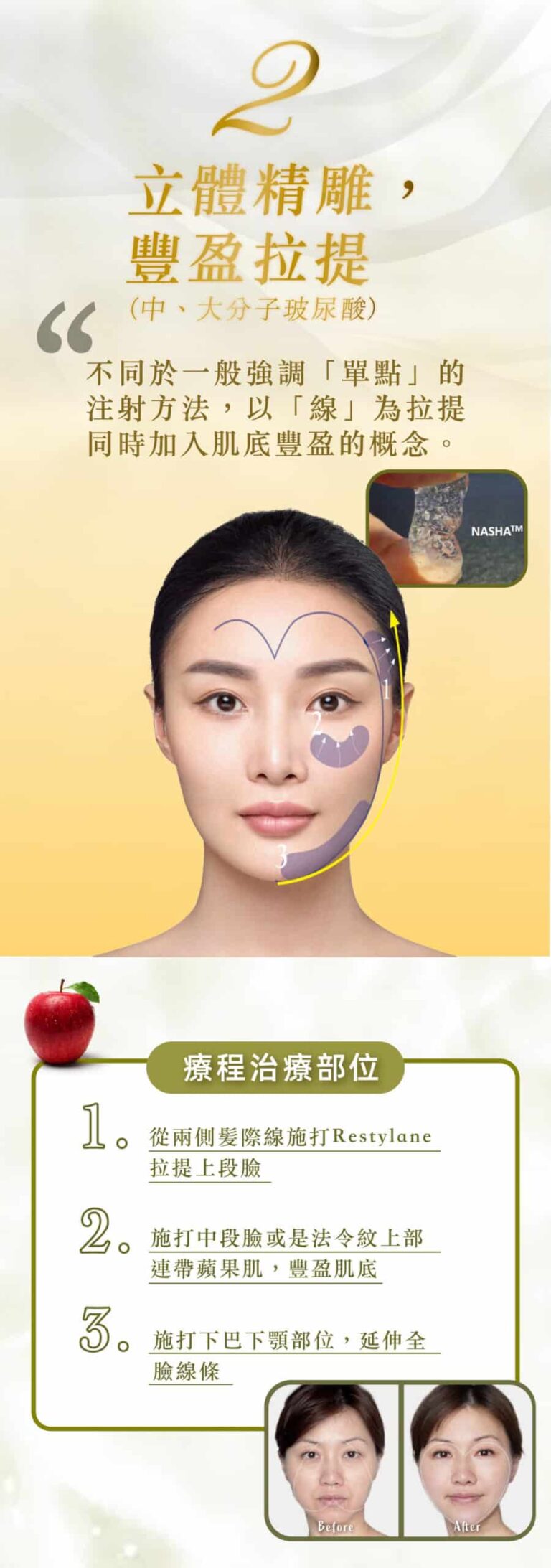 restylane_vs_juvederm