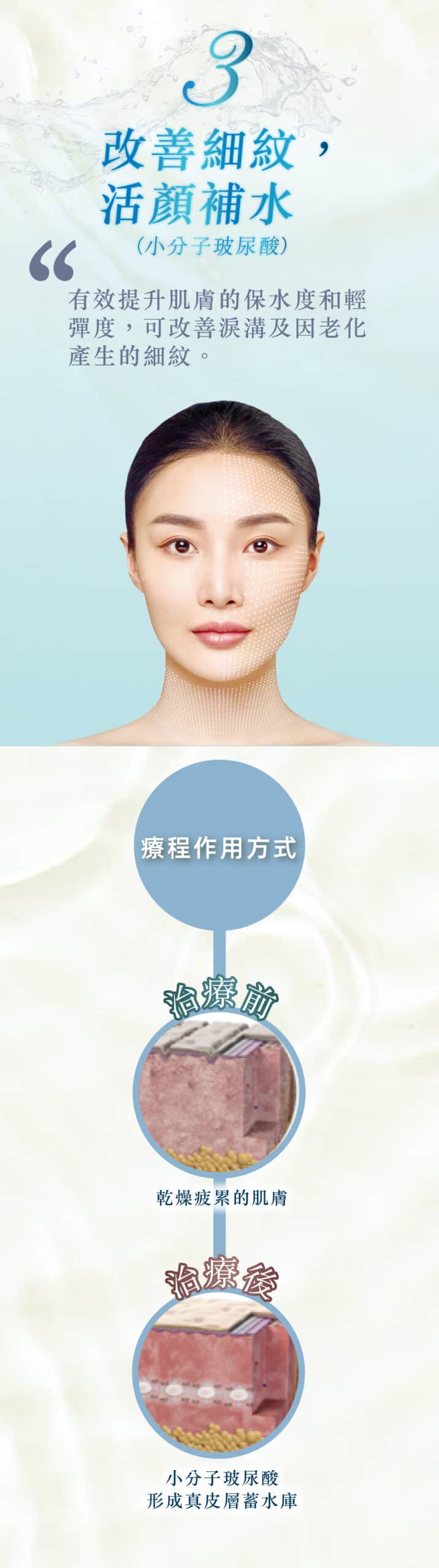 restylane_vs_juvederm
