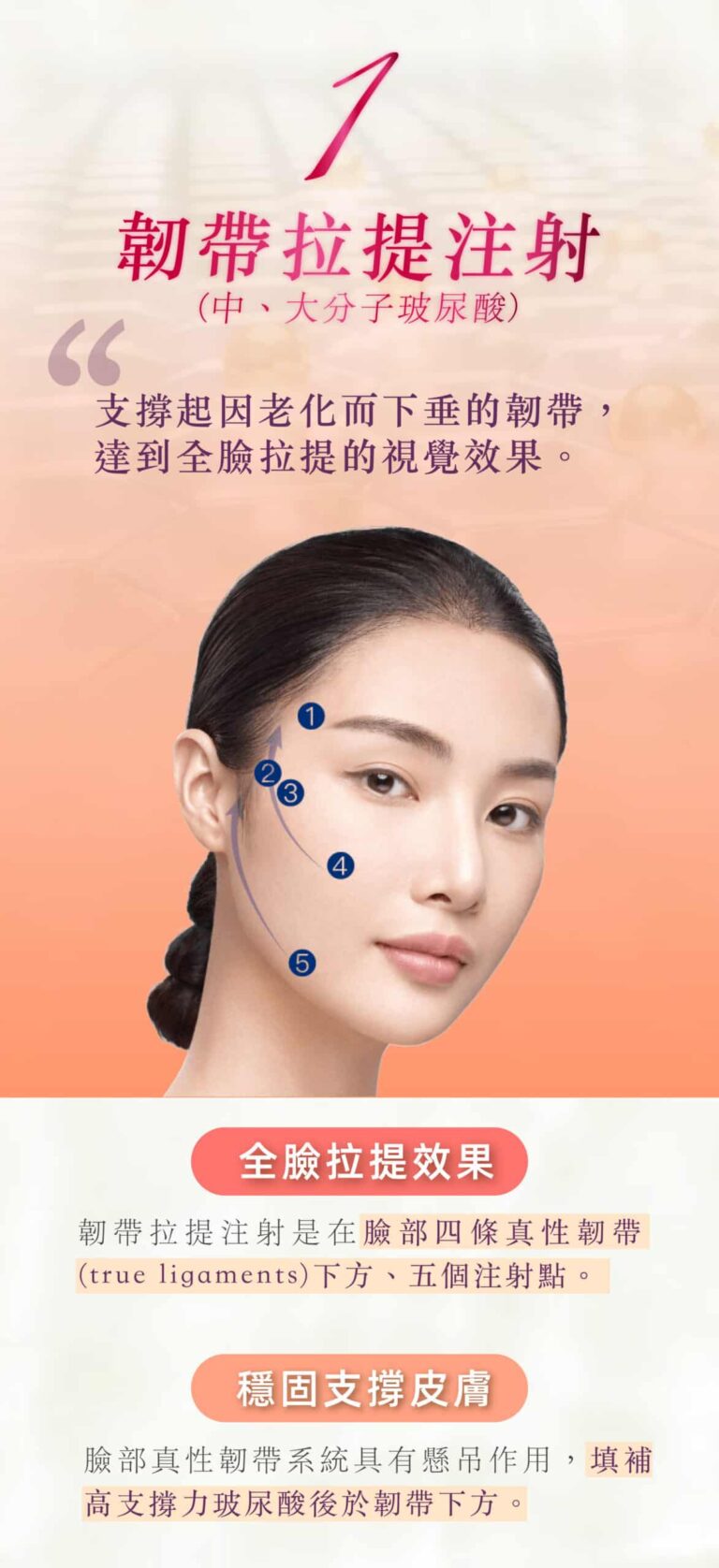 restylane_vs_juvederm