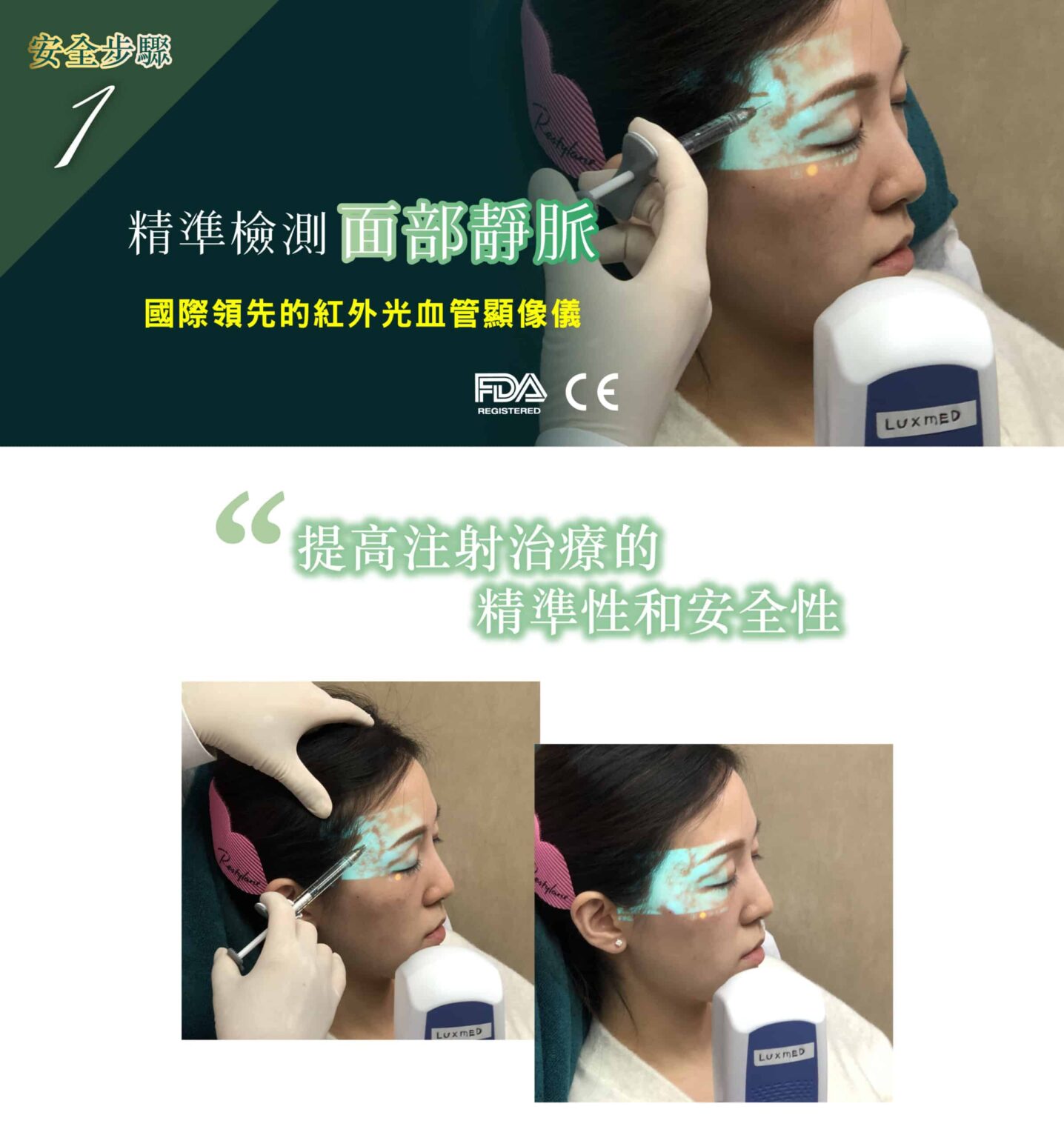 restylane