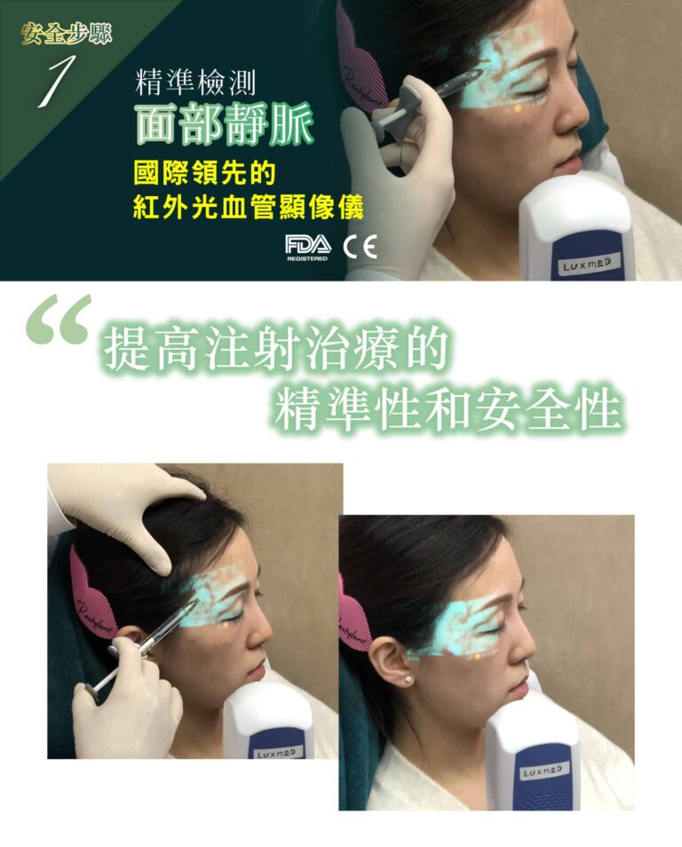 restylane