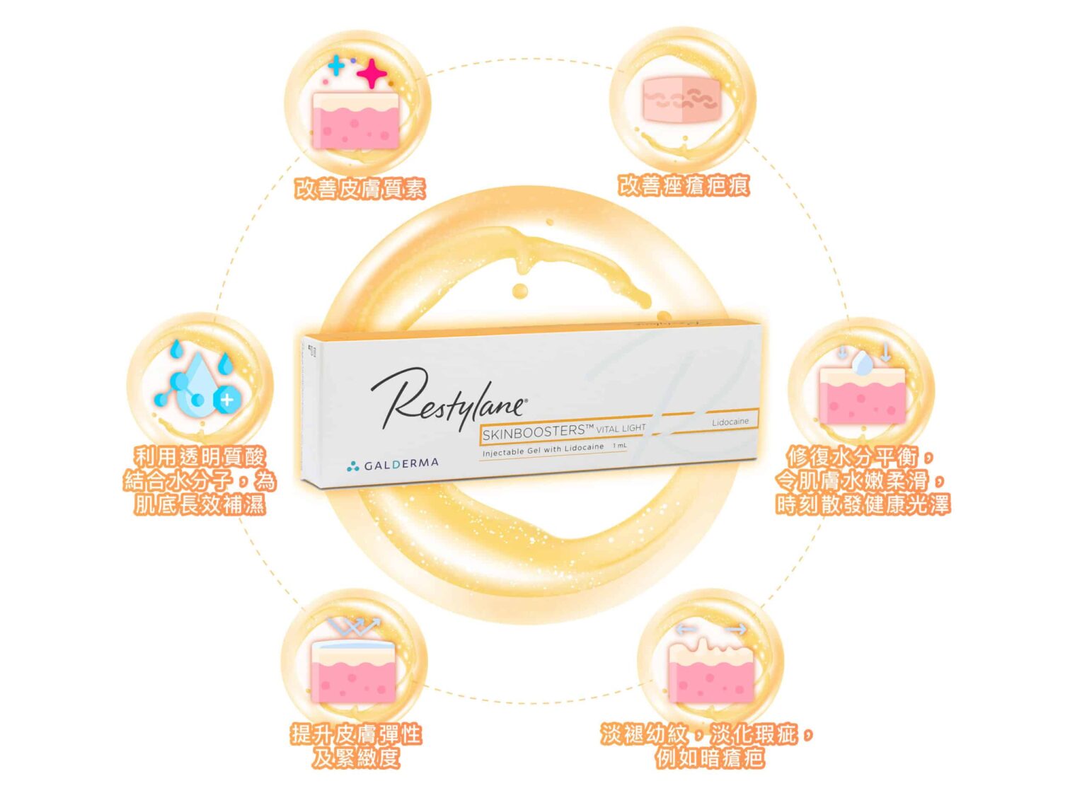 restylane