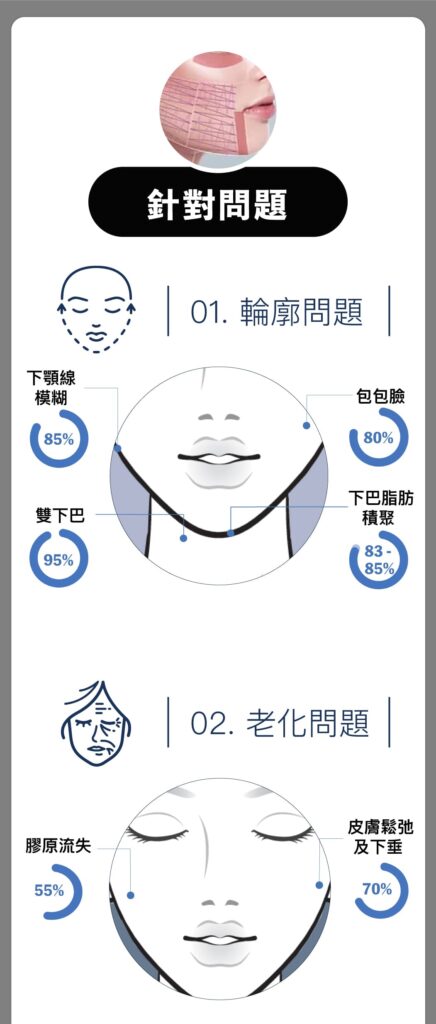 Hifu Q+ Hifu Q+