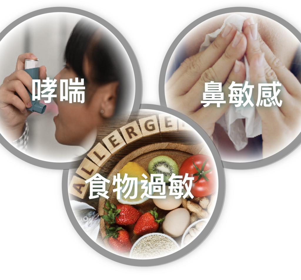 eczeme_and_allergy