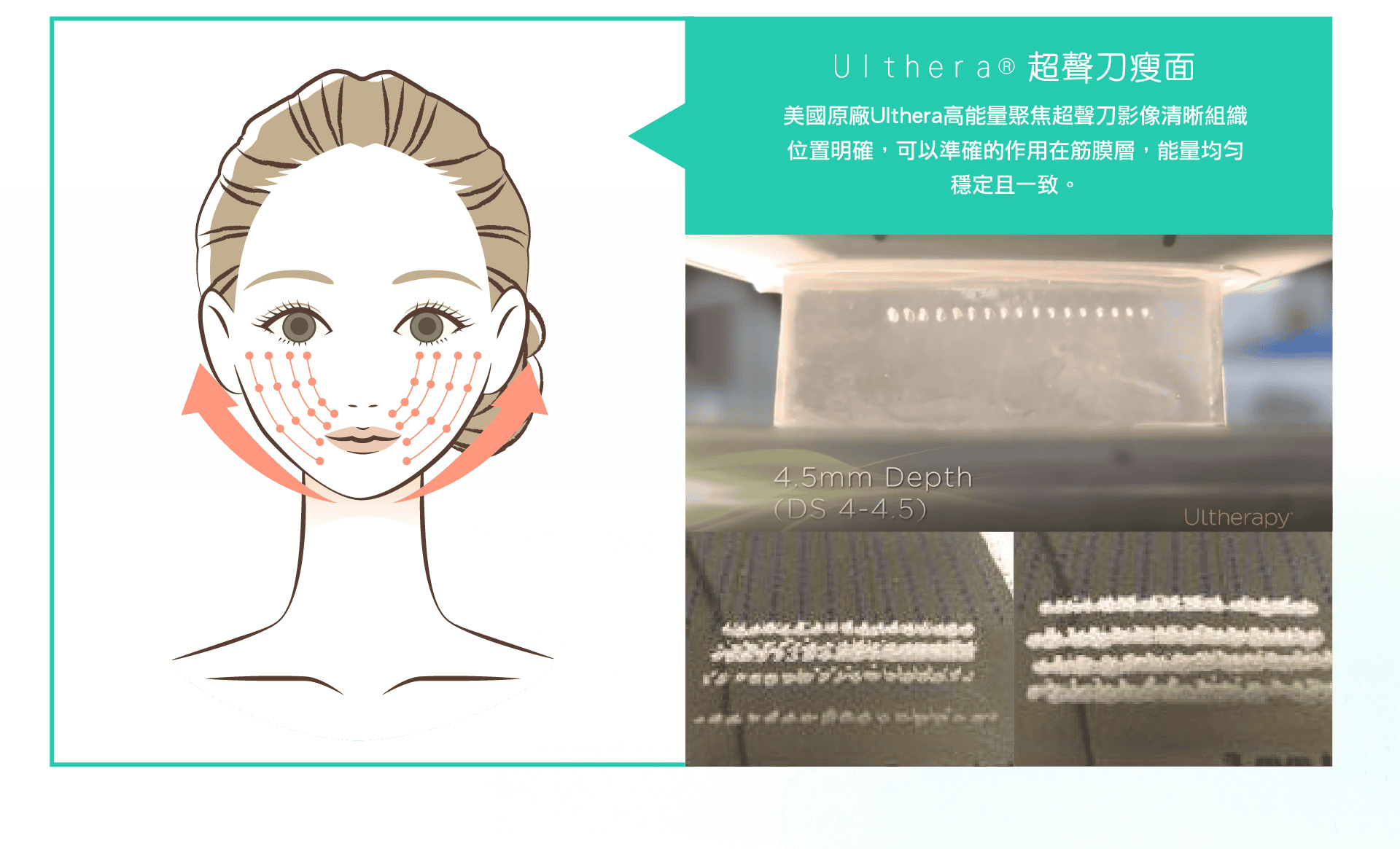 ulth2