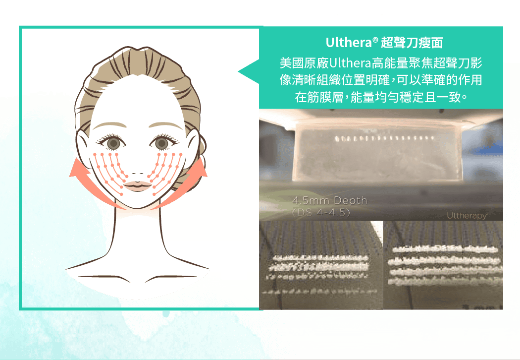 ulth2